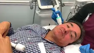 Voluderm Demo Lumenis Legend Pro - Face and Body Contouring