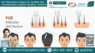 What is  FUE Hair Transplant? Let's keep it simple. | Hair Transplant Bangkok Thailand, Dr. Ming