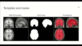 4.0 - MRI Templates and Masks - Course MRI preprocessing with Python