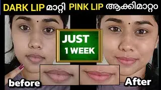Lip pigmentation can be changed at Zero Cost 💯 Working / Just One Week ❤&zwj;🩹( Malayalam )