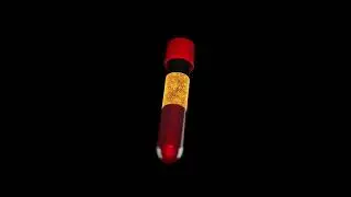 Vial Test