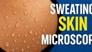 &ldquo;Sweating Skin Under the Microscope