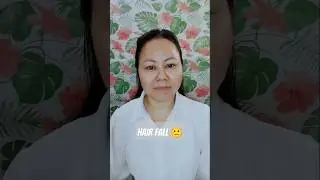Hair fall in Dubai #nepali #workindubai #uaeexperience
