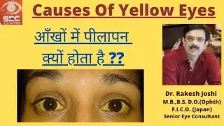 Yellow Eyes---Causes@eye Care by Dr Rakesh Joshi senior eye surgeon