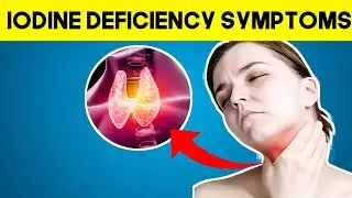 Low Iodine = Big Problems! 7 Symptoms You Shouldn&rsquo;t Ignore 🤯