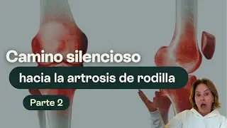 CAMINO SILENCIOSO HACIA LA ARTROSIS DE RODILLA PARTE 2
