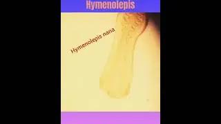 Dwarf tapeworm,Vampirolepis nana dance💃🕺intestinal worm👍Parasitology👌🔬✅
