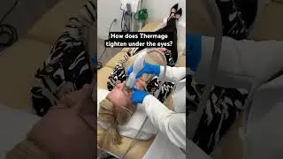 THE BEST WAY TO TIGHTEN UNDER EYE WRINKLES WITHOUT SURGERY #Thermage #antiaging #over40 #over50