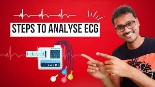 Steps to Analyse ECG