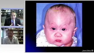 Endoscopic Management of Metopic and Lambdoid Synostosis (Preview)