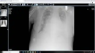 HIMSS Demo Training Original