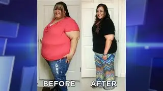 &lsquo;Virtual&rsquo; Weight Loss Surgery?