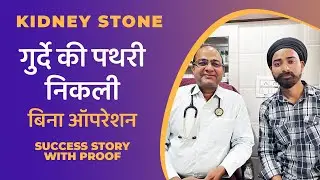 गुर्दे की पथरी निकली Success Story | Kidney Stone Removed With Proof
