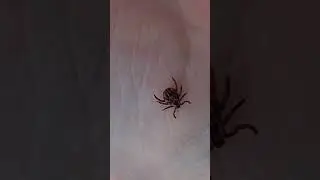 Подцепил клеща 😧