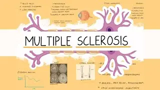 Multiple Sclerosis Made Easy | Exam