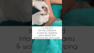 Stop Underarm Sweating with Botox Treatment | Jyoti Gupta Clinic
