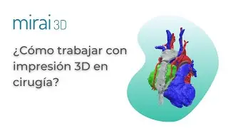 &iquest;C&oacute;mo se utilizan las tecnolog&iacute;as 3D dentro de quir&oacute;fano? - MIRAI 3D