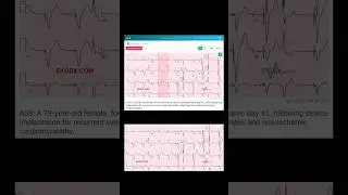 EKGDX - Vol II. ECG Challenges with ABIM format. #ecg
