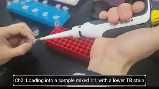 Right Trypan blue staining_SOL COUNT