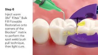 3M&trade; Filtek&trade; Dental Restoratives and Bioclear&reg;