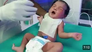 My new bron baby very hungry, first' bottle 🍼🍼 milk feeding 😋 blessings you baby 🐥