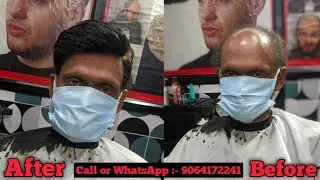 Tapping Hair Patch  | Hair Patch for men | Call Or WhatsApp :- 9064172241