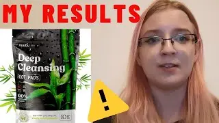 Nuubu Foot Patches Review - ⚠️ M RESULTS USING NUUBU - Nuubu Detox Foot Patches Reviews (Nuubu)