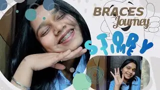 ✨Story Time *Braces* Journey✨ for my braces people🤍#braces#bracesjourney 