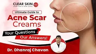 Ultimate Guide to Acne Scar Creams Questionnaire | Acne Scars के लिए Creams | ClearSkin, Pune