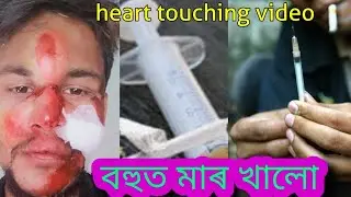 বহুত মাৰ খালো ॥ Assamese heart touching video #Drugsaddiction