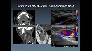 Dr. Kolokythas - Tips and Tricks in Body Imaging Procedures