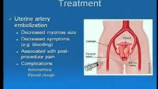 Gynecological Problems: Case Study Approach (Dr. Joyce King) Part 2