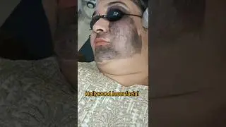 Hollywood Laser Facial| carbon laser peel|#cabonlaser #facial #skincare #beautytips #skincareroutine