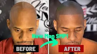 New Man SMP Review | Atlanta’s Finest in Scalp Micropigmentation