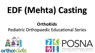 EDF (Mehta) Casting for Early-Onset Scoliosis