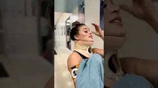 Girl wearing philadelphia collar neck brace