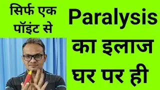 best acupressure points for right / left hemiplegia paralysis very effective points for paralysis