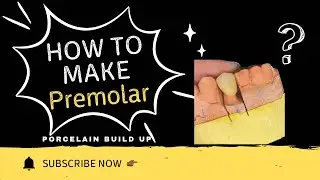 How to make #14 premolar porcelain crown