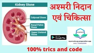 अश्मरी निदान एवं चिकित्सा | Ashmari Nidaan evam Chikitsa AIAPGET 2025 | ayurveda pg preparation app
