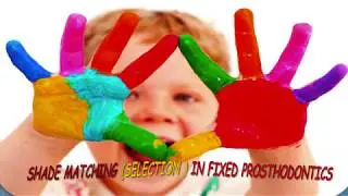 shade selection in fixed posthodontics