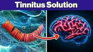 🎧 Silence the Ringing: Discover the Brain-Based Solution to Tinnitus with Sonus Complete!