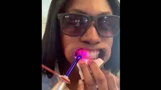 DIY Tooth Gems At Home