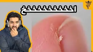 اشياء مؤلمة حصلت للكل 😑 !!