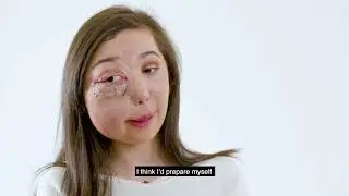 Face Equality 2018 - Young Champions with Visible Differences - #ProudToBeMe