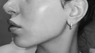 ♱ 𝓟𝘦𝘳𝘧𝘦𝘤𝘵 𝘴𝘬𝘪𝘯: pele perfeita + ser livre de manchas e acne.