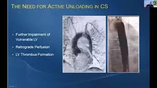 ECLS: VA ECMO - Why is LV Unloading Important? // Guest Presenter: Billy Stafford with Abiomed