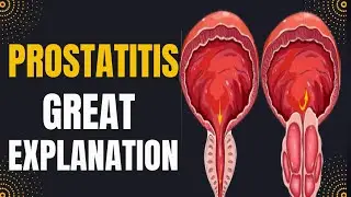 Prostatitis Causes, Symptoms, and Treatment