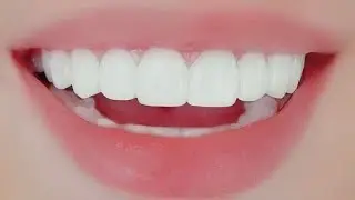 ・✧ Perfect Teeth & Smile 🎀💎 #subliminal 
