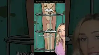 How this surgery makes you taller!