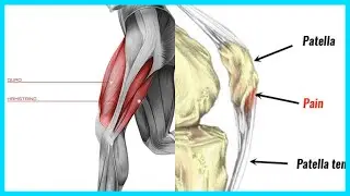 Overtraining Your MUSCLES Vs. Overtraining Tendons